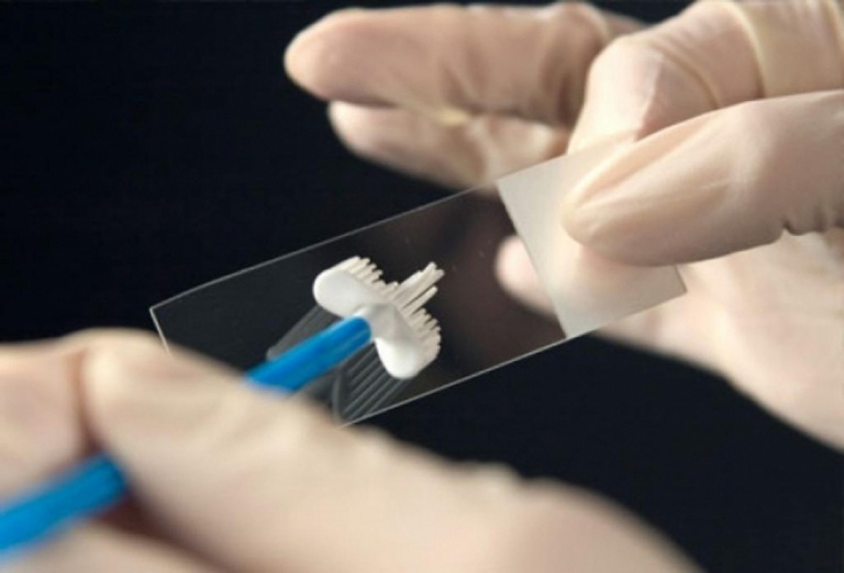 Причины белых и творожистых выделений у женщин без запаха