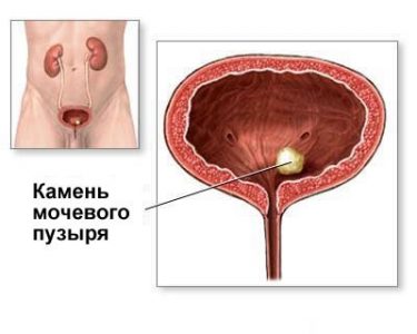 Изображение 11