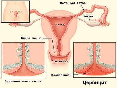 Картинка 3