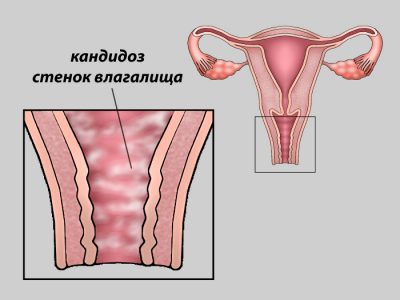 Иллюстрация 5