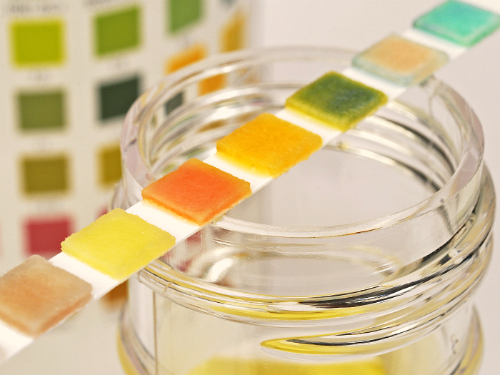 Как осуществляется сдача мочи на общий анализ?