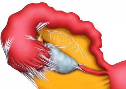 Иллюстрация 4