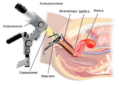 Иллюстрация 2