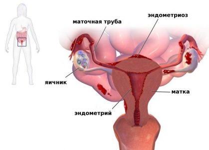 Иллюстрация 9