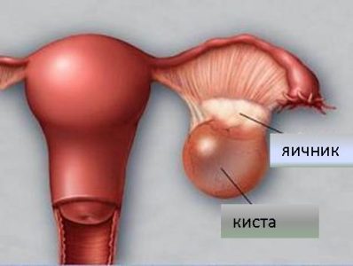 Иллюстрация 4