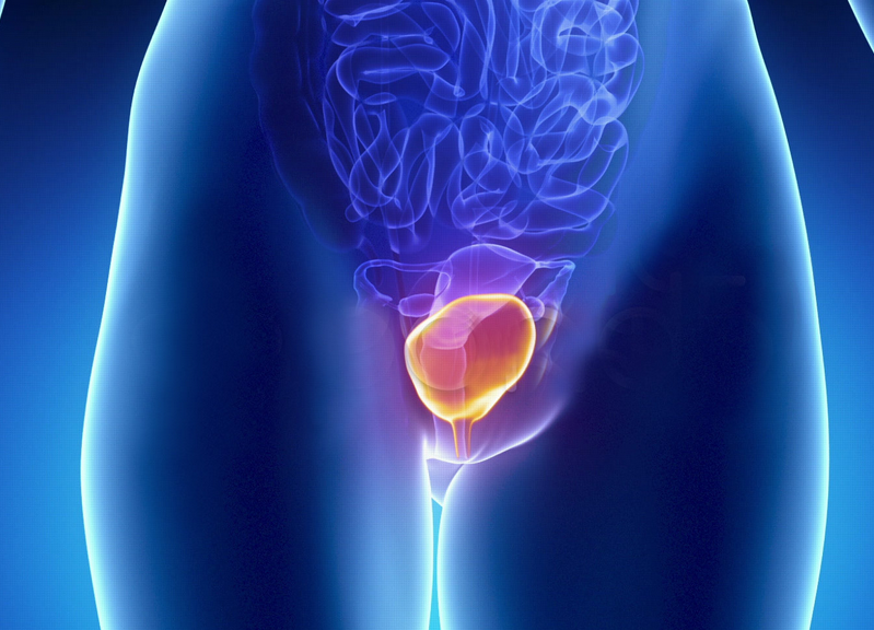 Вульвит: острый и хронический, чем проявляется у женщин репродуктивного возраста и как его лечить