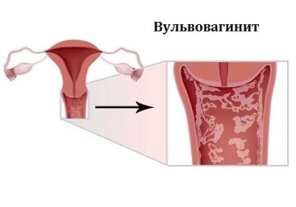 Иллюстрация 1