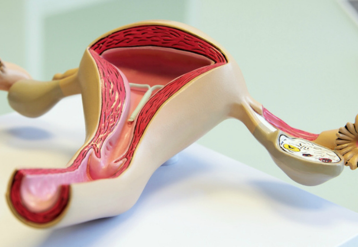 Что такое рубцовая деформация шейки матки?