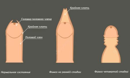 Иллюстрация 2