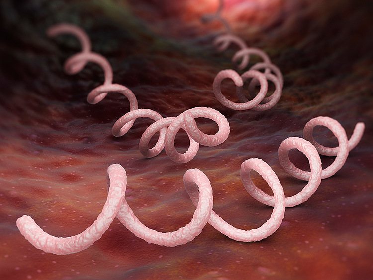 Что такое бледная трепонема, как её обнаружить и лечить?