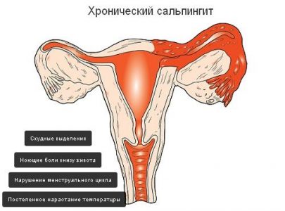 Картинка 3