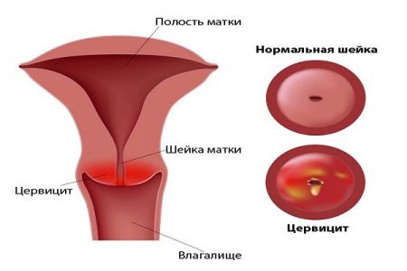 Иллюстрация 1