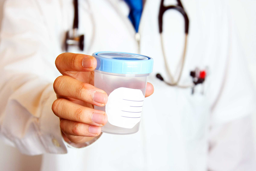 Подготовка к сдаче спермограммы: предварительные мероприятия