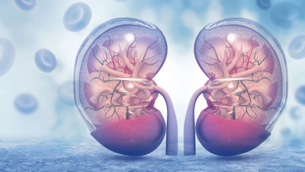 Песок в почках: причины, симптомы и лечение