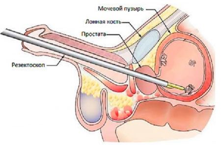 Иллюстрация 4