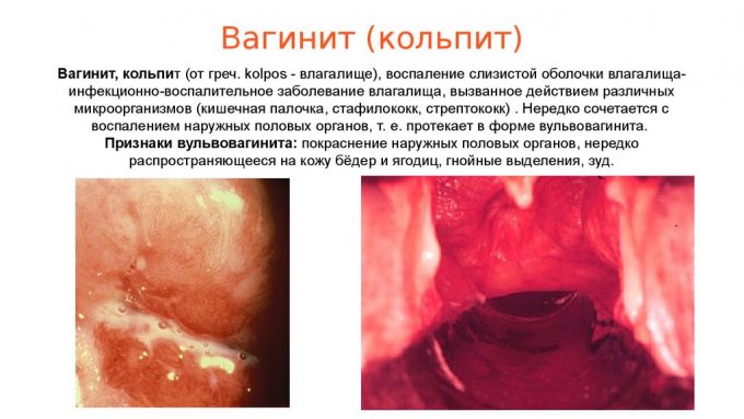 Картинка 3