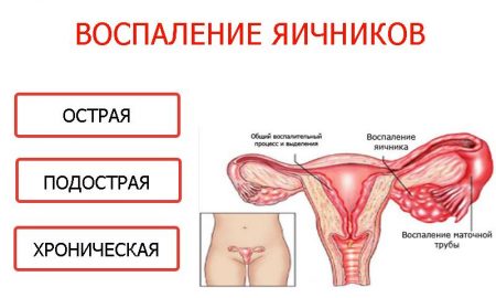 Иллюстрация 1