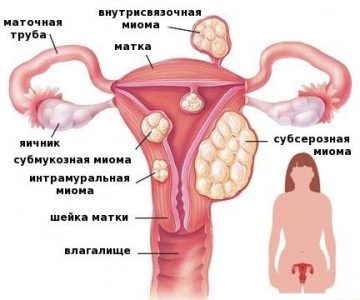 Иллюстрация 1