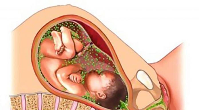 Хламидиоз при беременности: опасность, симптомы и лечение