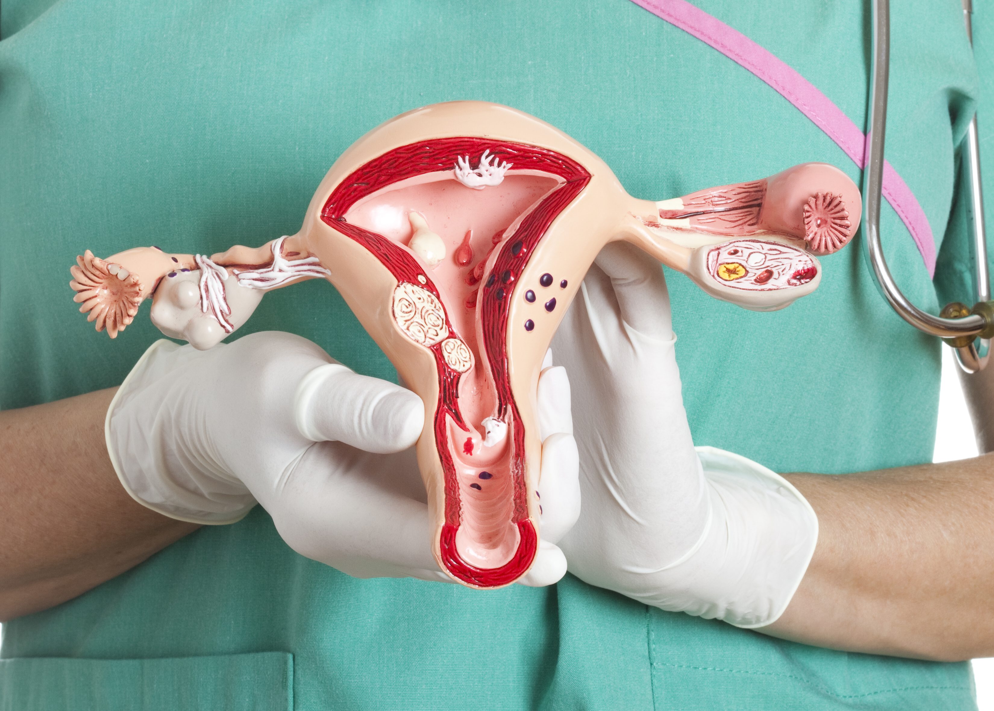 Фолликулярная киста яичника: причины, симптомы, осложнения и лечение