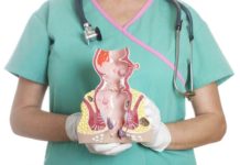 Чем занимается проктолог?