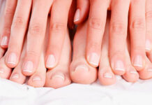 Как вылечить грибок ногтей и что нужно делать, чтобы он не побеспокоил вас?