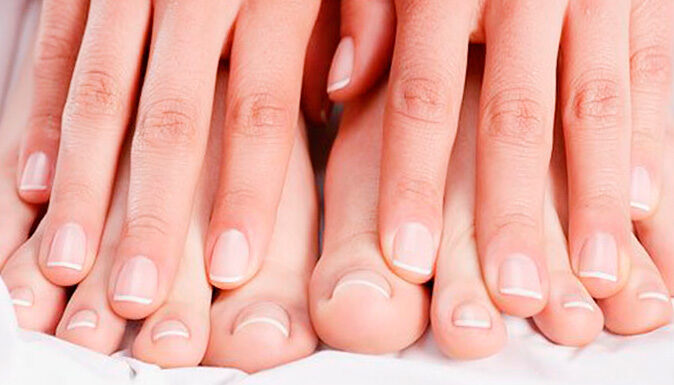 Как вылечить грибок ногтей и что нужно делать, чтобы он не побеспокоил вас?