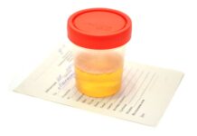 Диагностическая значимость анализа мочи