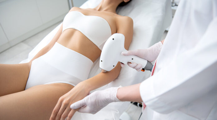 Лазерная эпиляция: разбираемся в деталях