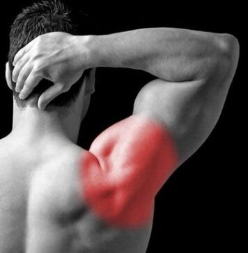 Метод лечения привычного вывиха плеча