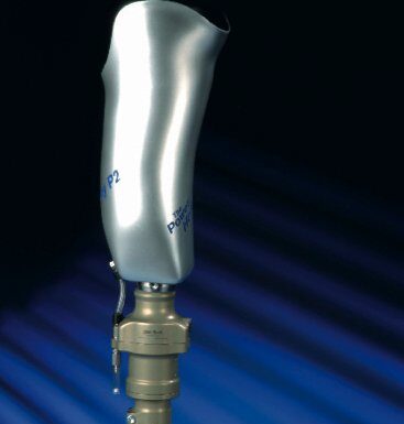 Способы крепления протеза бедра к культе