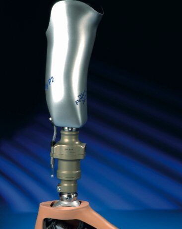 Способы крепления протеза бедра к культе