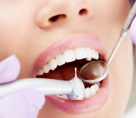 Лечение кариеса: борьба с разрешений твёрдых тканей зуба