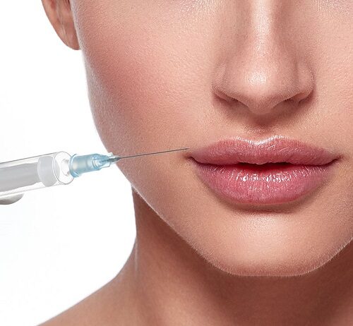 Особенности увеличения губ гиалуроновой кислотой
