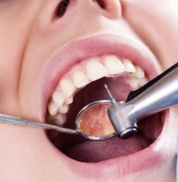 Что делать если у вас запущенная форма кариеса?