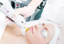 Преимущества лазерного лечения акне