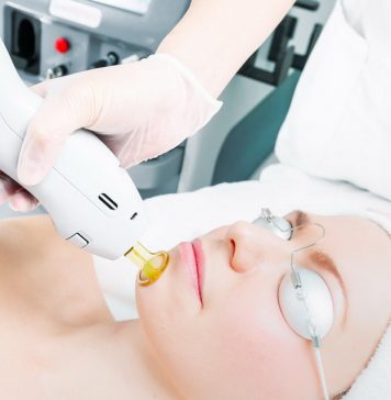 Преимущества лазерного лечения акне