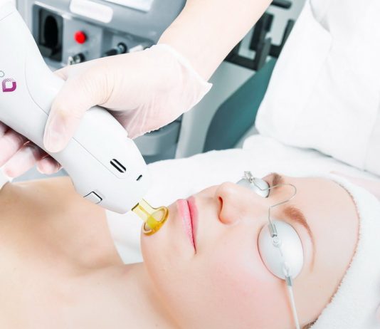 Преимущества лазерного лечения акне