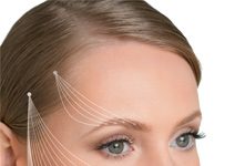 Контурная пластика Radiesse: плюсы и минусы