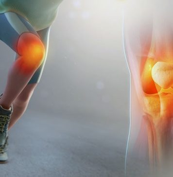 Что такое колено бегуна и как его лечить?