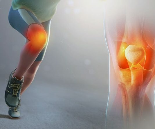 Что такое колено бегуна и как его лечить?