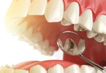 Профилактика и лечение кариеса