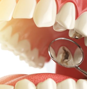 Профилактика и лечение кариеса