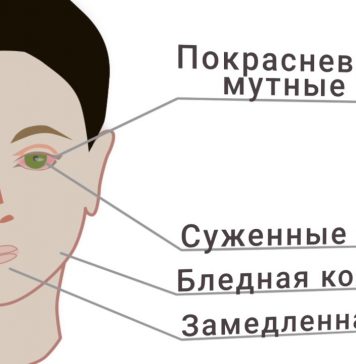 Как определить, что подросток принимает наркотики
