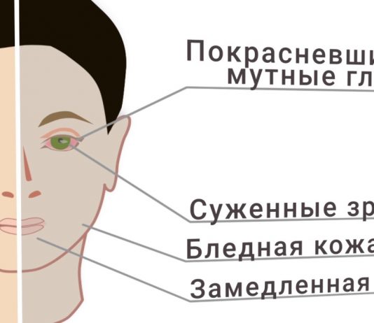Как определить, что подросток принимает наркотики