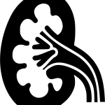 5 причин обрати клініку «Urologist Valetskyi», якщо вам потрібна літотрипсія