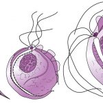 Трихомониаза: причины, симптомы и лечение