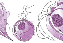 Трихомониаза: причины, симптомы и лечение