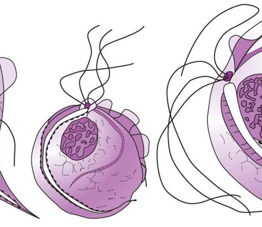 Трихомониаза: причины, симптомы и лечение
