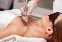 Показания для удаления папиллом лазером